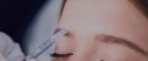 Microbotox Torino - per rughe, pori dilatati e pelle impura